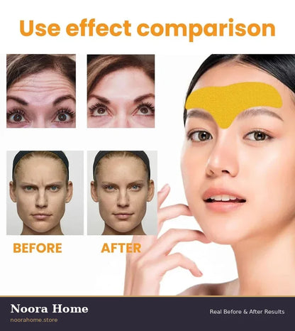 Woman Forehead Smooth Wrinkle Patches